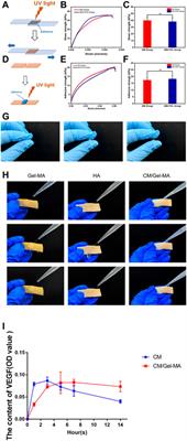 Effect of stem cell conditional medium-loading adhesive hydrogel on TGF-β1-induced endometrial stromal cell fibrosis